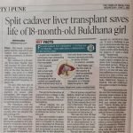 Liver Transplant - Dr. Vishnu Biradar