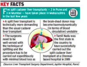 Liver transplant